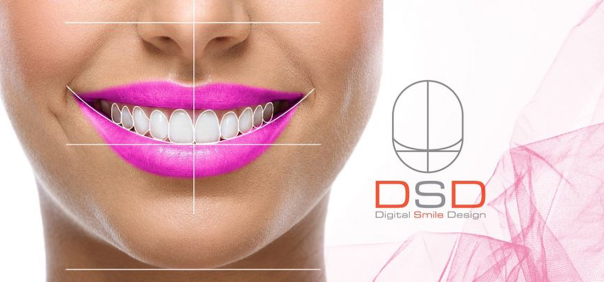 DT Smile Care Slider